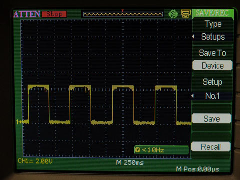 ナノトラッカー正常パルス(知人提供)