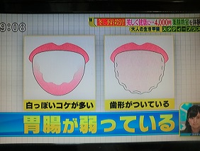 20151107_サタデープラス03_舌 - コピー.JPG