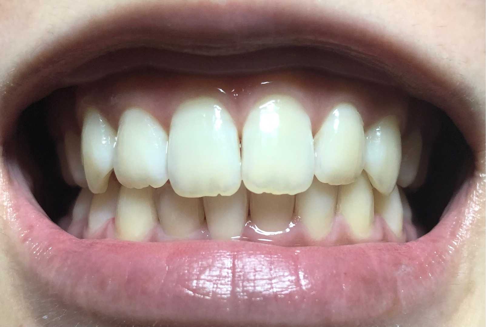 カテゴリ未分類 いい歯日記 楽天ブログ