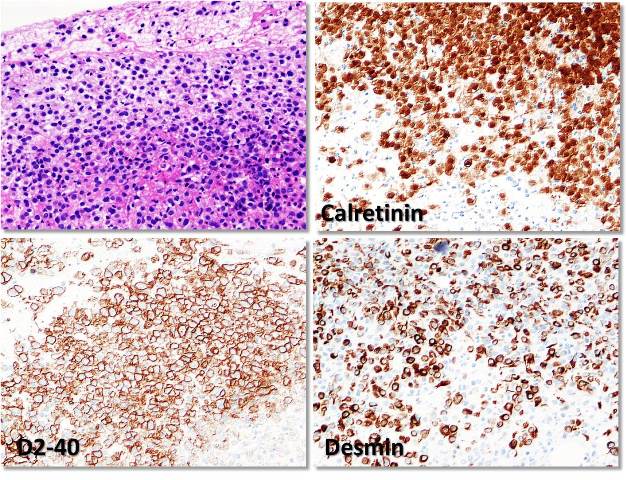 デクスミンシロップのリーフレット