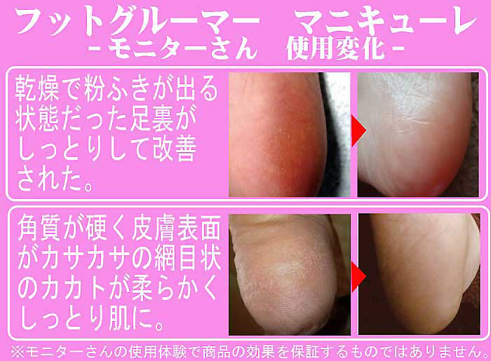 フットグルーマー「マニキューレ」2