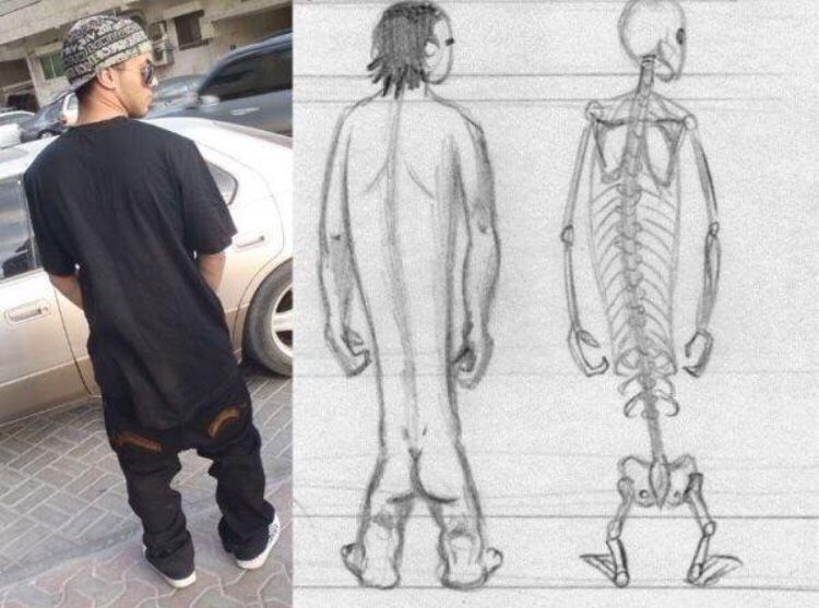 腰パン ファッションの危険性のついて 裏ゆるふわ劇場 Pc版での閲覧を推奨します 楽天ブログ