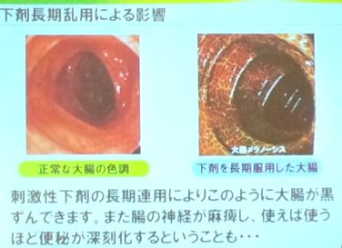 サンファイバー05.jpg
