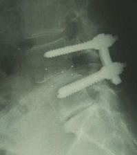 henseisuberiope2.jpg