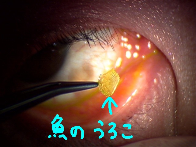 魚のうろこ.jpg