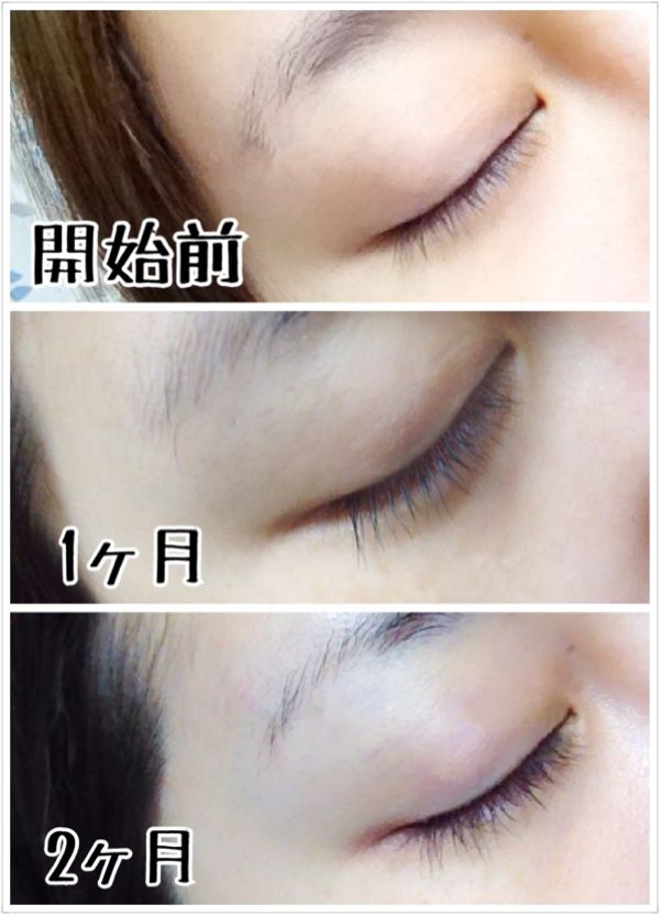 美容のこと いっつきんぐだむ 楽天ブログ