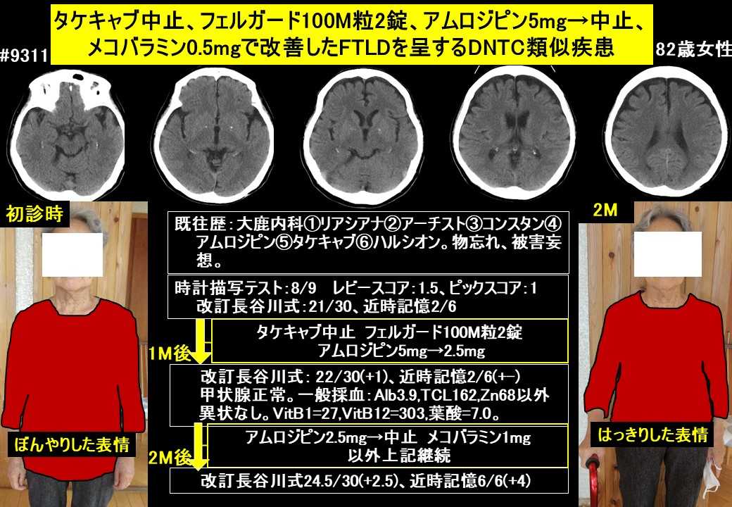 ドクターイワタの認知症ブログ2022年11月6日 | ドクターイワタの認知症 