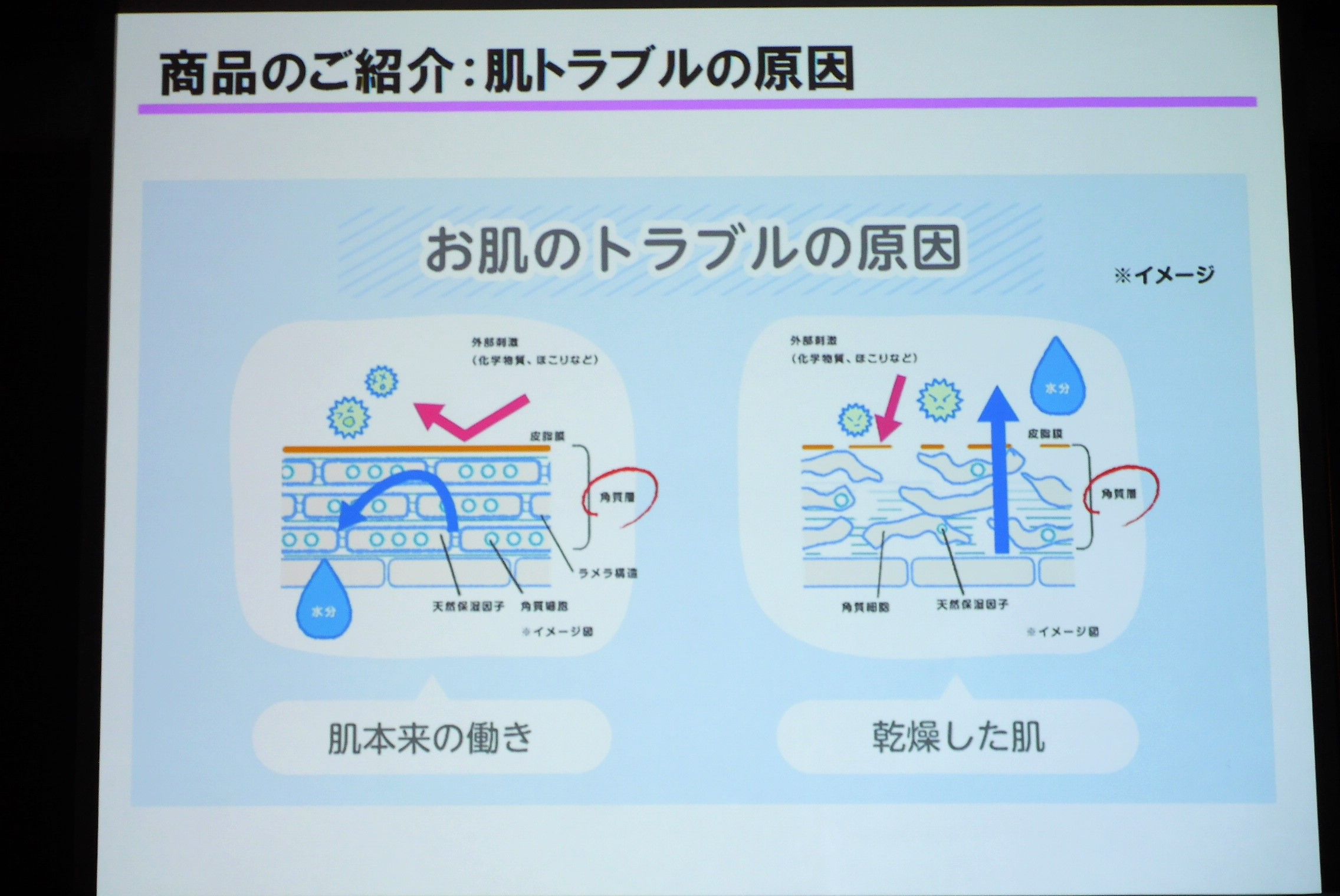 へパドロイド油性クリーム_肌トラブルの原因