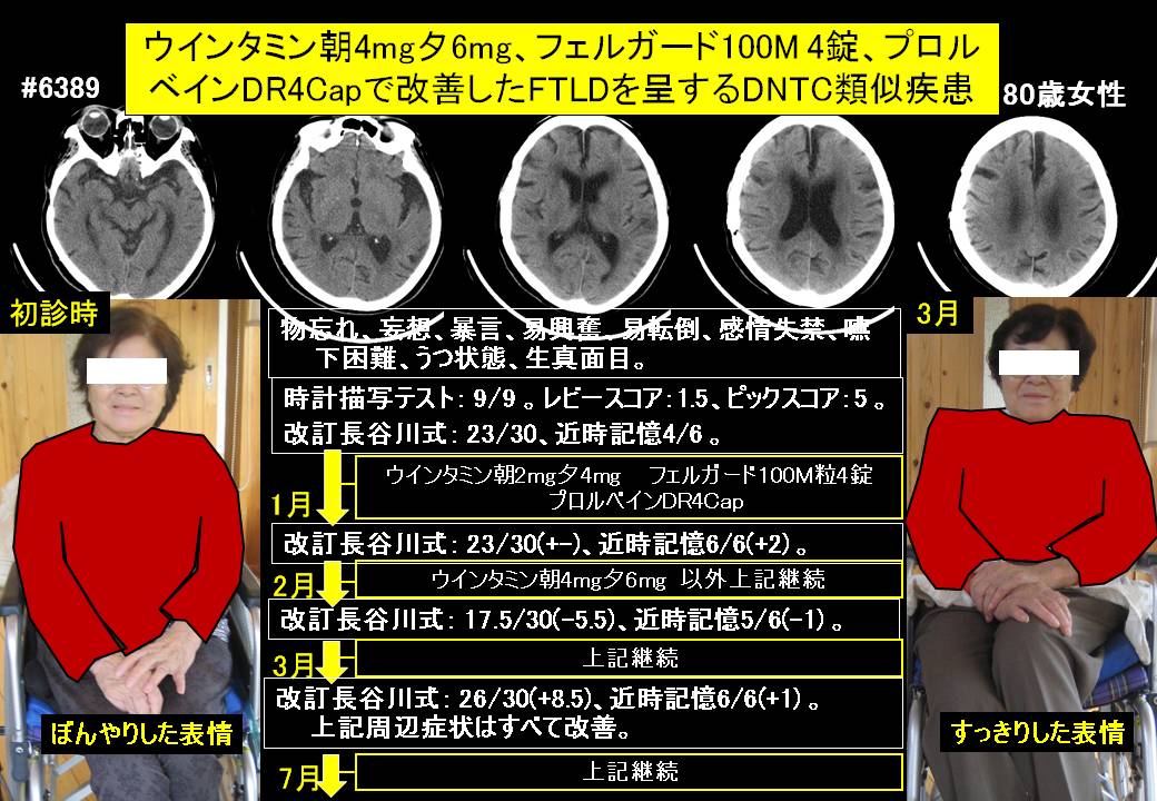 20161211@6389@844