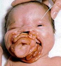 種 奇形 胎児 用 www.dfe.millenium.inf.br :