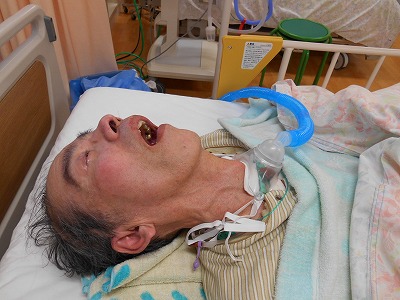 喉から直接酸素吸入になりました