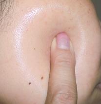 うるおいリング