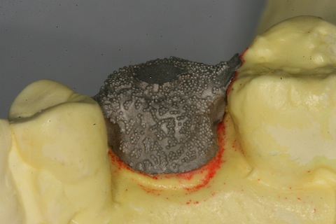 IMG_7036 のコピー.JPG