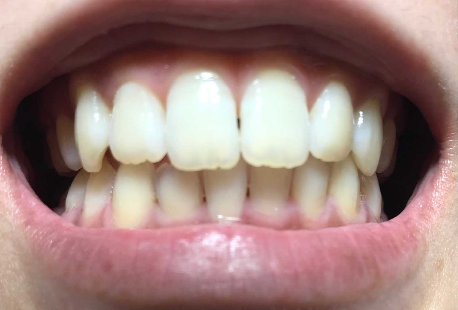 カテゴリ未分類 いい歯日記 楽天ブログ