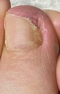 爪 徒然手芸とゲームと趣味 2 5舞台そのほか 楽天ブログ