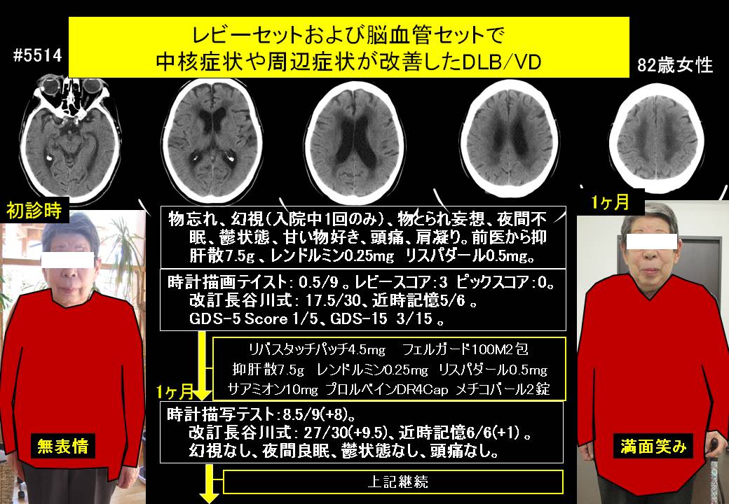 20141212@5514@291