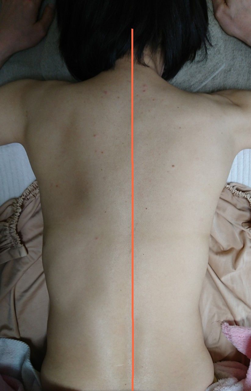 健康 の記事一覧 リンパひろママのブログ 楽天ブログ