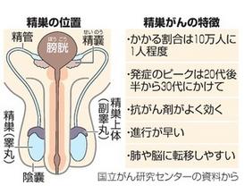 癌治療情報 の記事一覧 ワルディーの京都案内 楽天ブログ