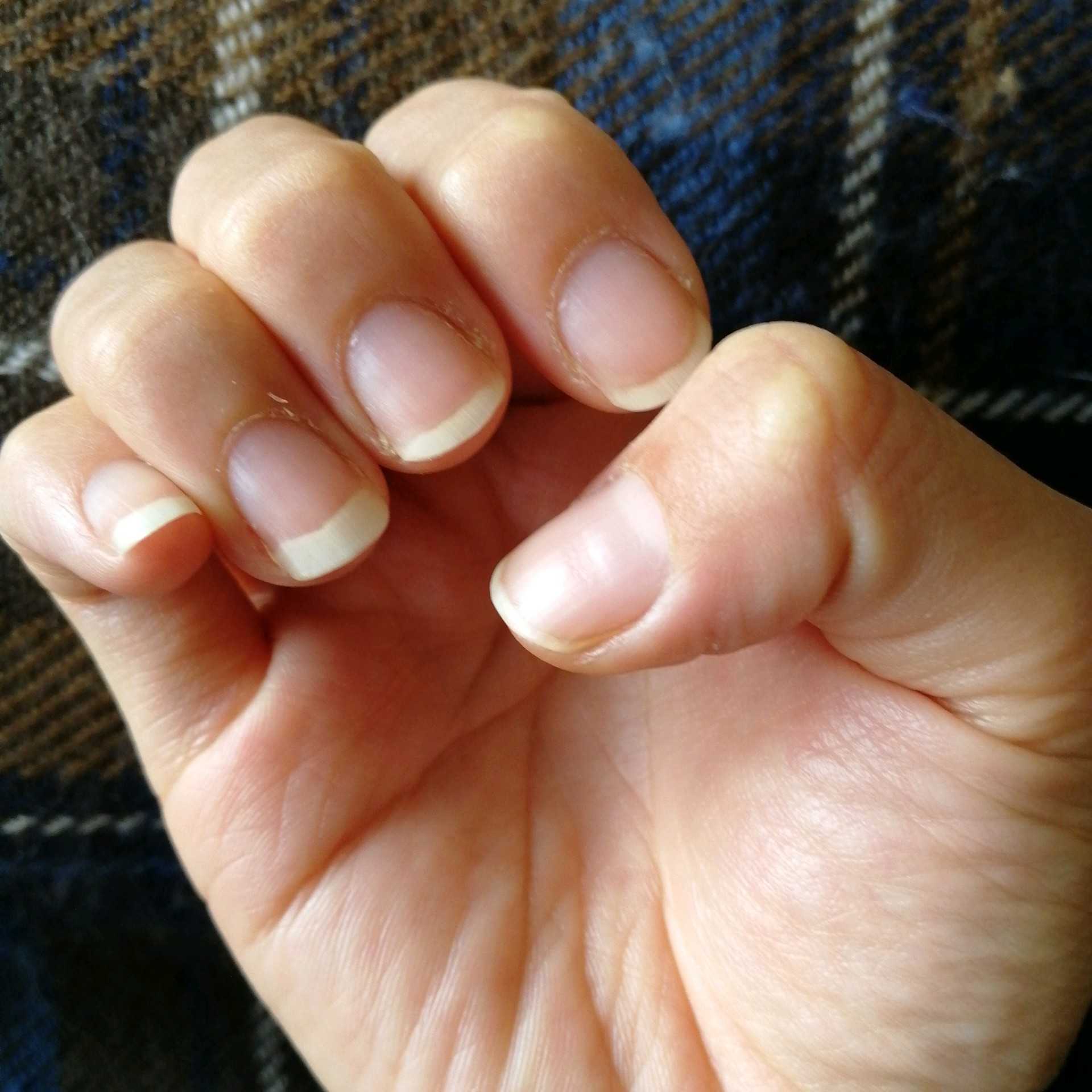 自爪美人で好印象 Nailbase ネイルベース 7種の天然オイルと美容液 よりまるの日記 楽天ブログ