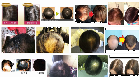 ひまし油 カスターオイル が育毛や円形脱毛症にもいいかもな件 長岡市の髪と地肌にやさしい大人のマンツーマンヘアサロンｒｉｖｅｒｓ リバース のブログです 楽天ブログ