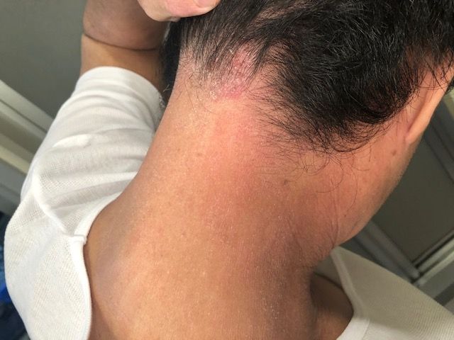 新着記事一覧 ナグアレルギーのブログ 楽天ブログ 新着記事一覧 ナグアレルギーのブログ 楽天ブログ