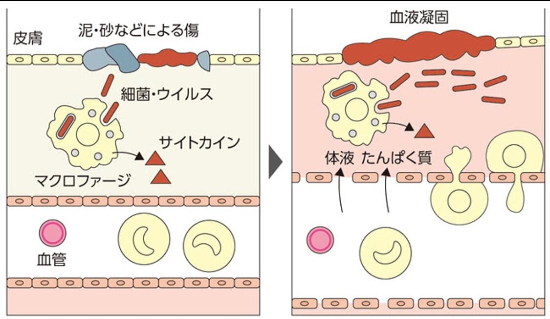 飲酒と免疫力 飲酒により免疫力が下がり 肺炎のリスクが上がってしまうという研究結果 Tomoraku の徒然 楽天ブログ