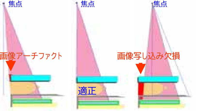 マンモグラフィ 品質管理 | ちゃんぷるー - 楽天ブログ