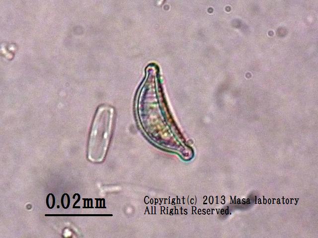 ギョウザケイソウ