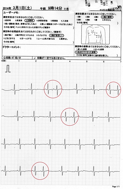 心電図