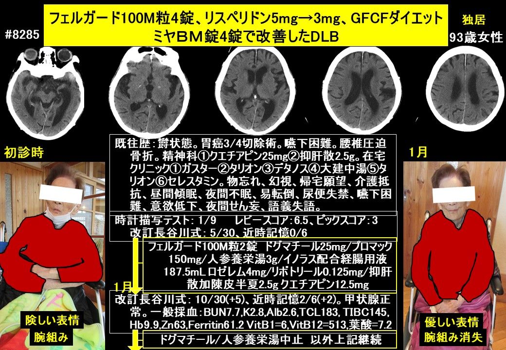 ドクターイワタの認知症ブログ2020年2月3日 ドクターイワタの認知症 発達障害ブログ 認知症専門外来と認知症専門往診を融合 楽天ブログ