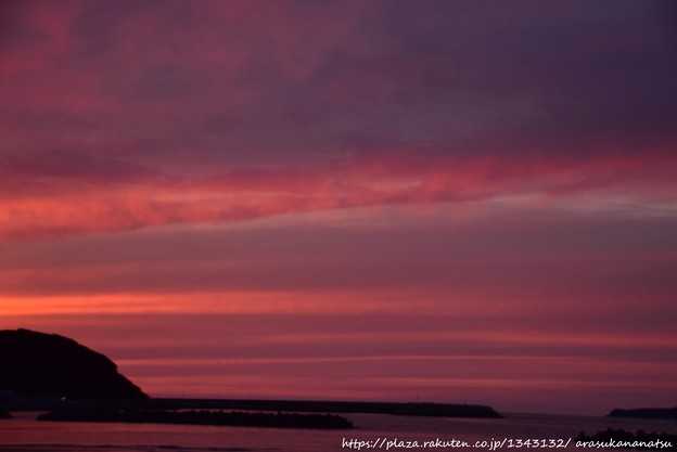 湿性壊疽は、迅速な治療が必要な医学的緊急事態です。 壊疽とは何ですか?