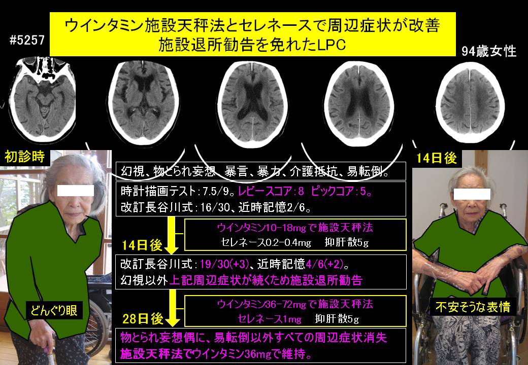201400620@5257@160