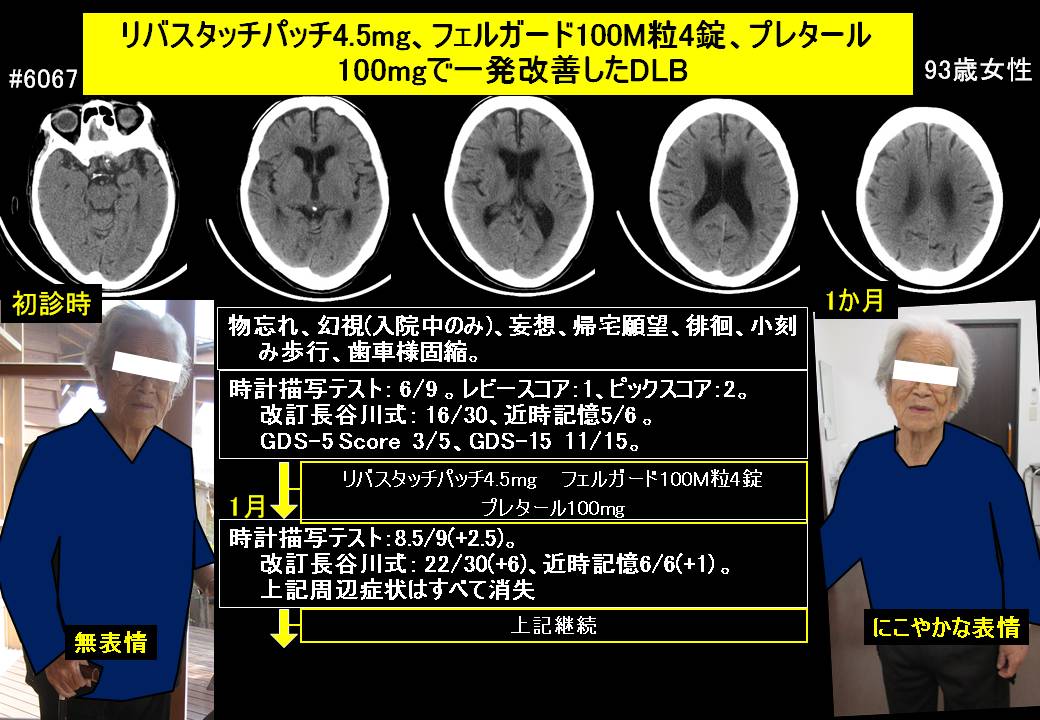 20151129@6067@568