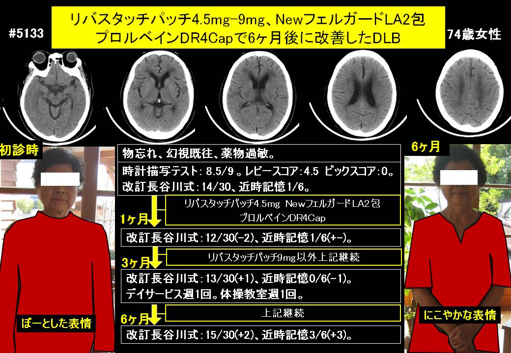 20141010@5133@244
