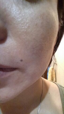 2ページ目の記事一覧 スキンケア やめました 楽天ブログ