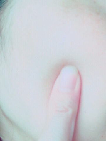 活潤リフトエッセンス15
