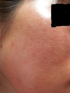 20120824_172315.jpg