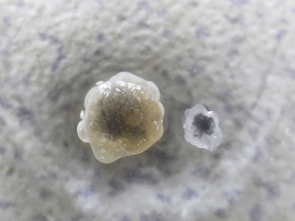 タマコブムシ（Ichthyotaces pteroisicola）1　セトミノカサゴの寄生虫　メス
