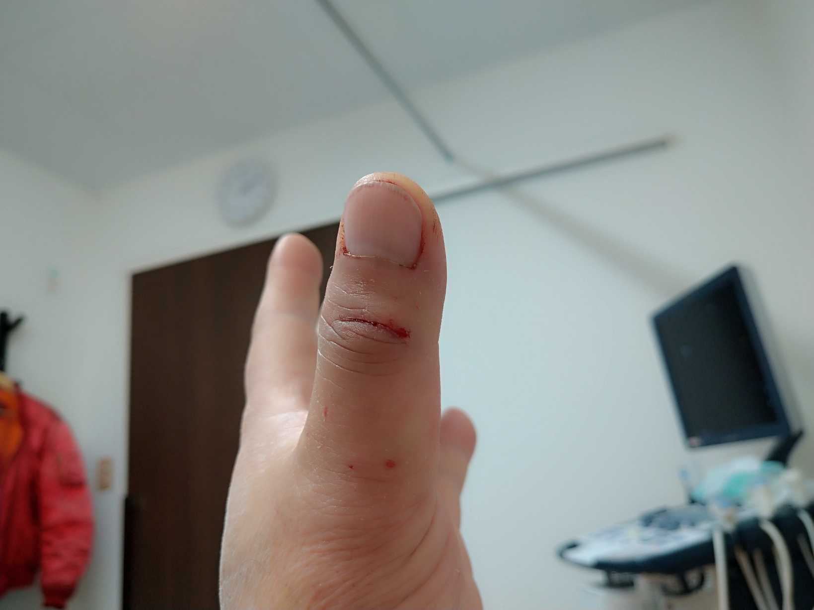 またやってしまいました いしちゃんの趣味の部屋 楽天ブログ またやってしまいました いしちゃんの趣味の部屋 楽天ブログ