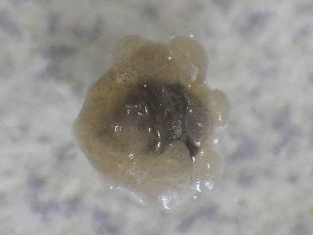 タマコブムシ（Ichthyotaces pteroisicola）3　セトミノカサゴの寄生虫　メス