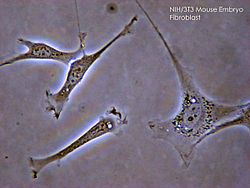 250px-Fibroblast.jpg