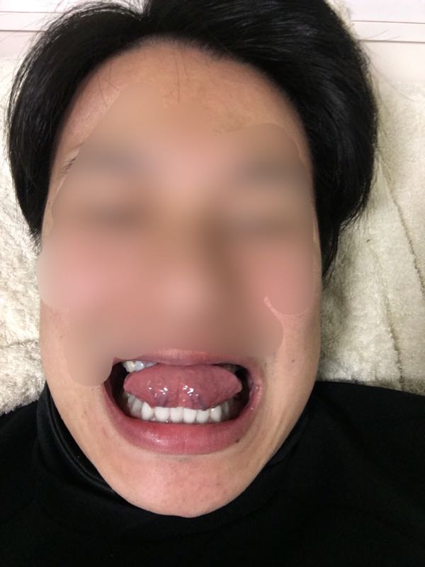 rblog-20161130212532-02.jpg