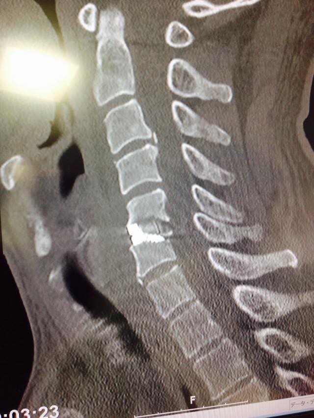 11263953_849659701777285_8073529659694470784_n (1).jpg