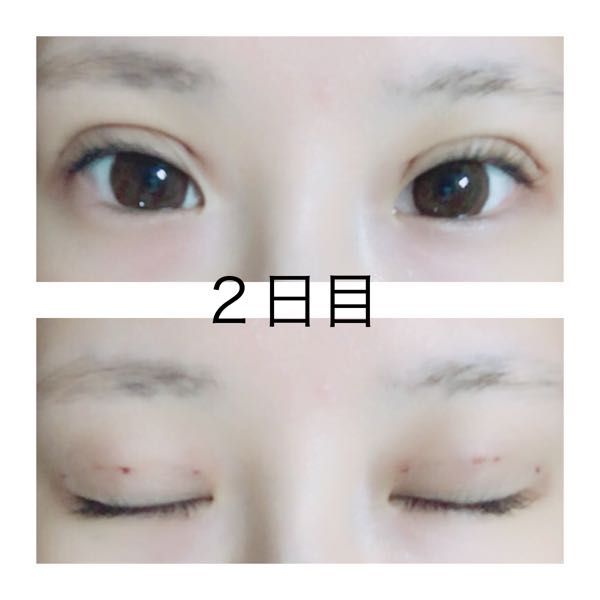 記事一覧 男ウケ 効果的アイテムまとめ あざと女子 楽天ブログ