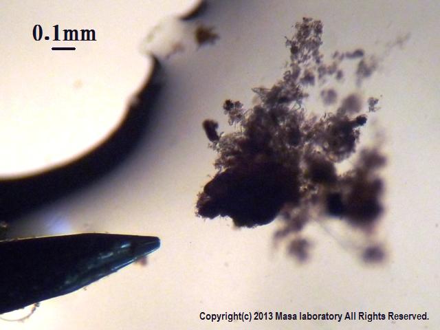 引きこもりをほぐす