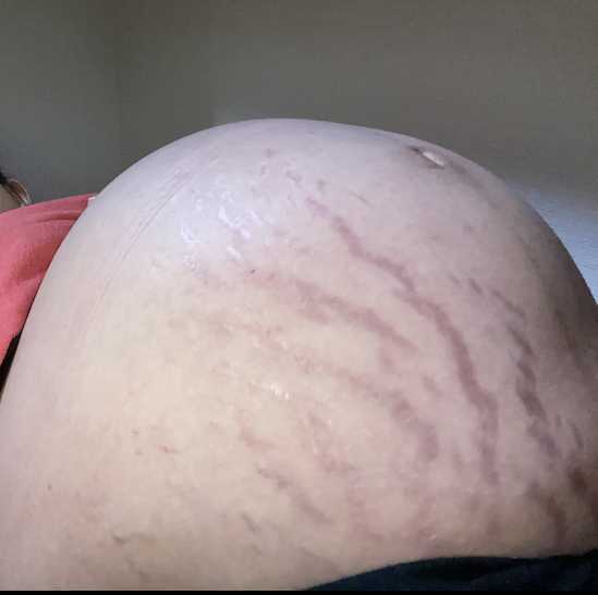 巨大児息子の出産レポ 爆買い少女の館 楽天ブログ