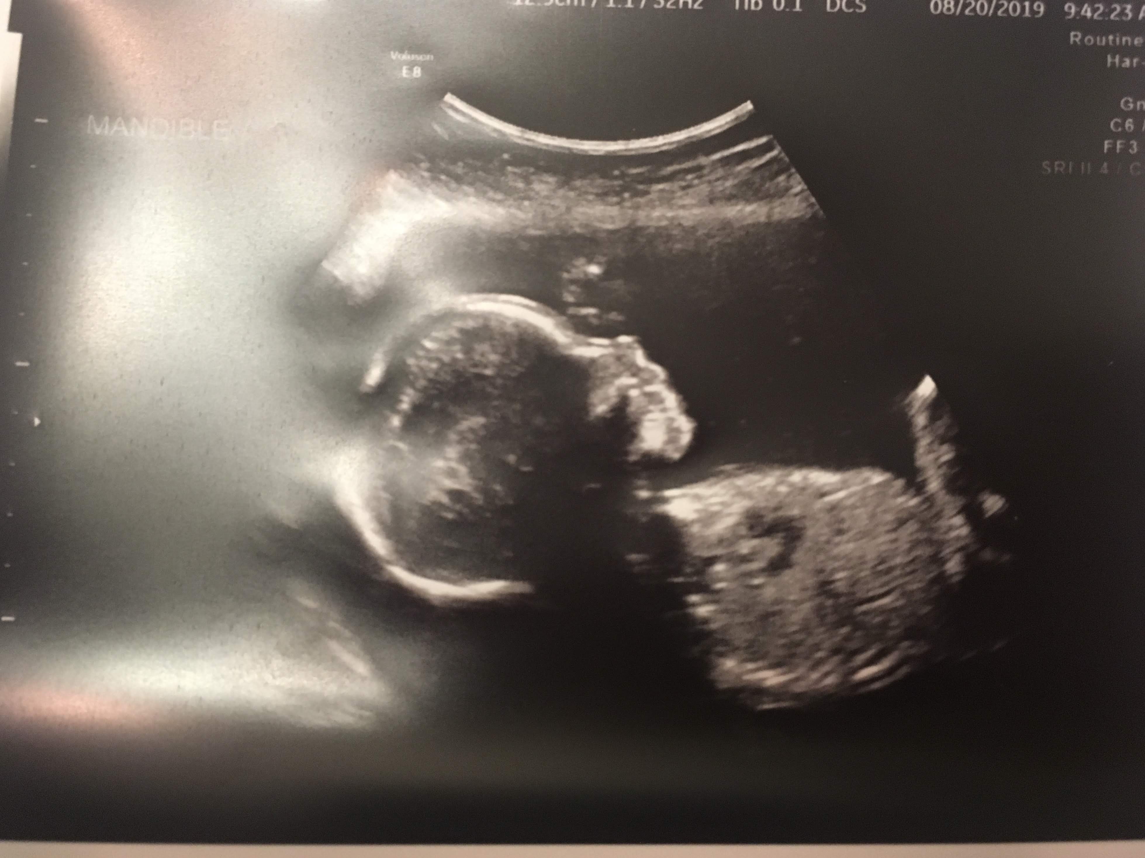 妊娠経過 ケチケチ母ちゃんと息子のあそび日記 Inシカゴ 楽天ブログ