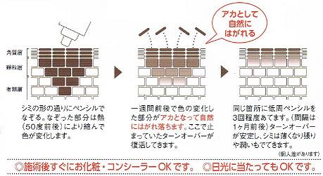 シミ　説明(小）.JPG