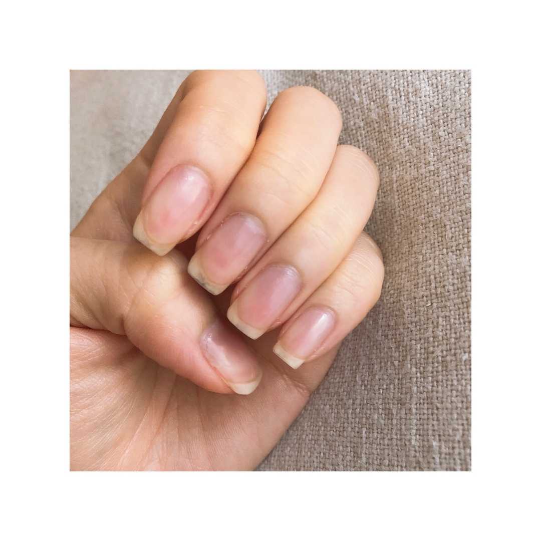 爪日記 1ヶ月を終えて ハルミツコム 楽天 楽天ブログ