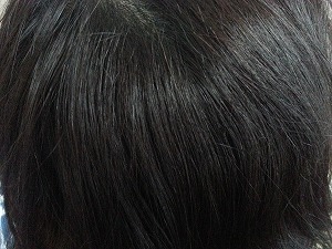 ブローネ